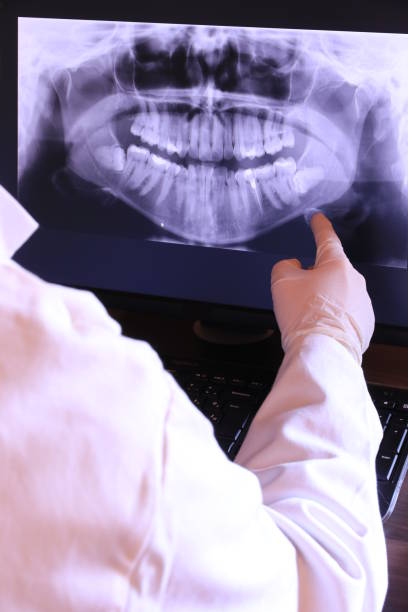 Best Emergency Wisdom Teeth Removal in Highwood, IL